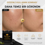 Aktif Karbon Sabunu | Akne & Sivilce ve Gözenek Karşıtı Detoks Bakım | 105g. - Görsel 4