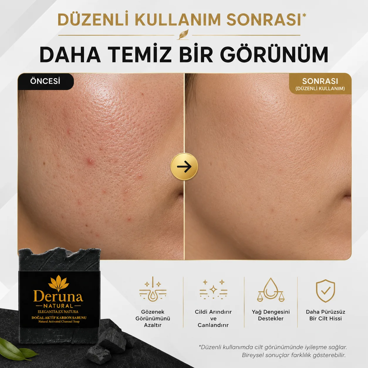 Aktif Karbon Sabunu | Akne & Sivilce ve Gözenek Karşıtı Detoks Bakım | 105g. - Görsel 4